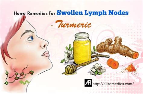Natural Remedies for Swollen Lymph Nodes