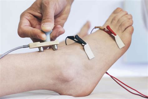 Nerve Conduction Tests and Other Diagnostic Tools