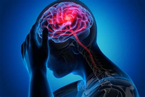 Neurological Effects