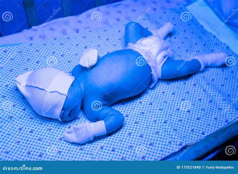 Newborn Jaundice Treatment at Home