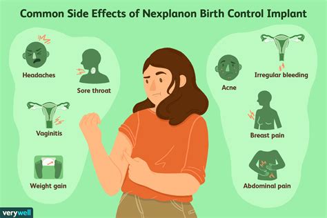 Nexplanon Effectiveness