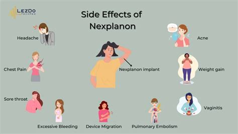 Nexplanon Side Effects