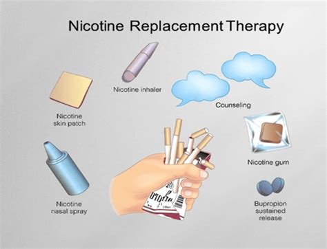Nicotine Replacement Therapy