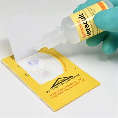 Occult Blood Test Results