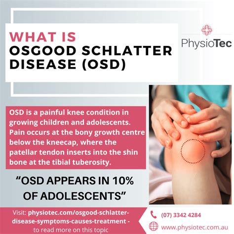Osgood Schlatter Disease Causes