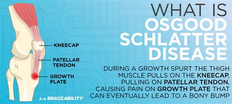 Osgood Schlatter Disease Complications