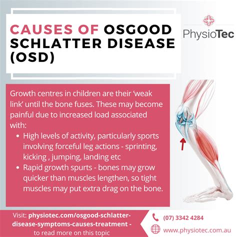 Osgood Schlatter Disease Prevention