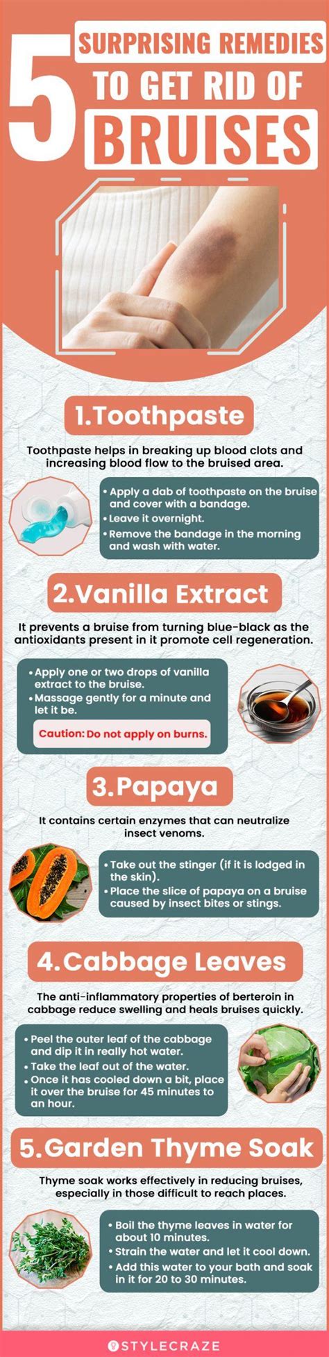 Over-the-Counter Treatments for Bruises