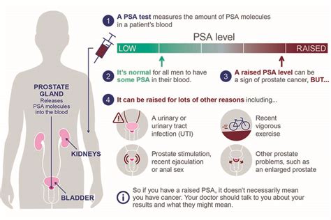 PSA Test Risks