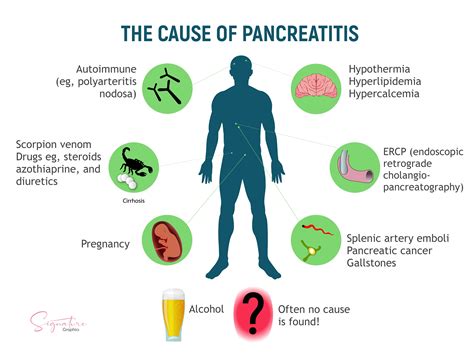 Pancreatitis Causes