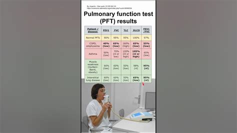 PFT Test Results