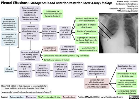 Pleural Effusion