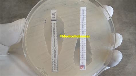 Polymyxin B Introduction