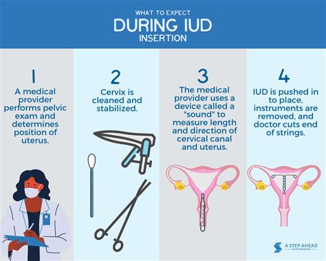 Post IUD Removal Care