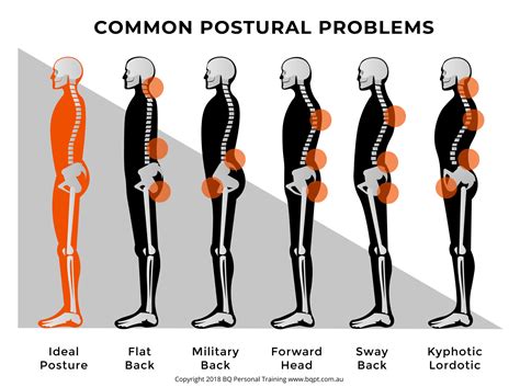 Posture-Related Body Pain