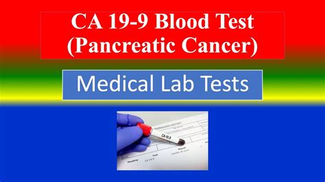 Practical Applications of CA Blood Tests
