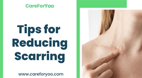 Practical Tips for Reducing Scarring