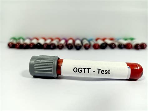Preparation for Oral Glucose Test