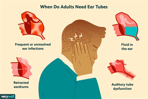 Preparation for Ear Tube Insertion
