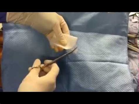 Preparation for Inguinal Hernia Repair Surgery