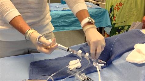 Preparation for Left Heart Cath Procedure