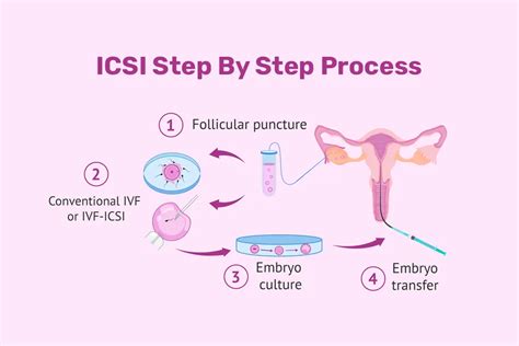 Preparing for ICSI
