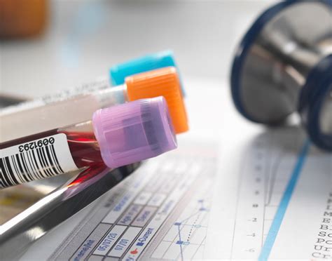 Preparing for LD Blood Test