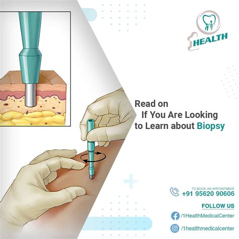 Preparing for a Bone Biopsy