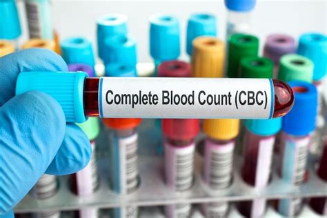 Preparing for a Total Blood Count Test