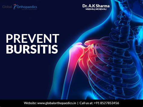 Preventing Bursitis