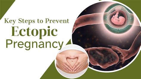 Preventing Ectopic Pregnancy