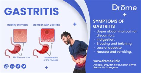 Preventing Gastritis