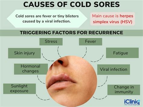 Preventing Herpes Cold Sore Virus Symptoms