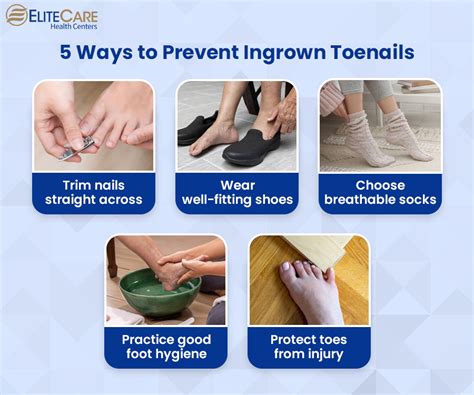 Preventing Ingrown Toenails