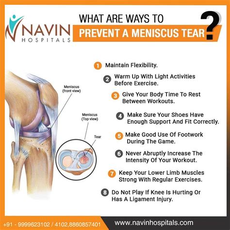 Preventing Meniscus Tears
