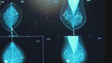 Preventing Sore Lymph Nodes