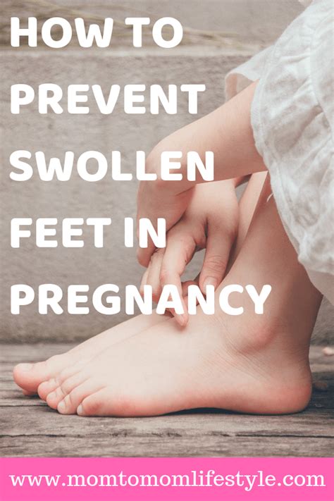 Preventing Swollen Feet During Pregnancy