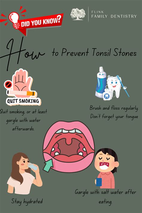 Preventing Tonsilloliths