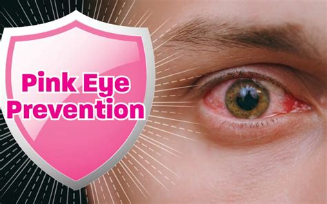 Prevention Methods for Pink Eye