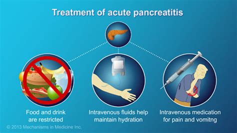 Prevention and Management of Pancreatitis