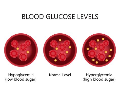 Prevention of Abnormal Blood Glucose Levels