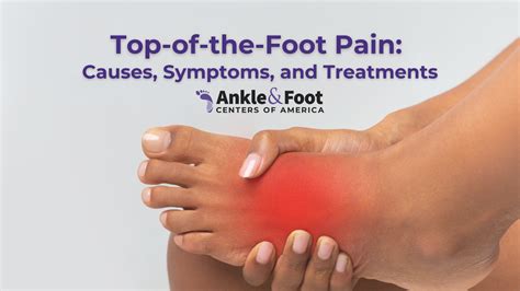 Prevention of Foot Pain