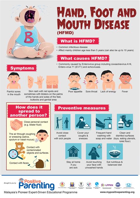Prevention of Hand Foot Mouth Disease