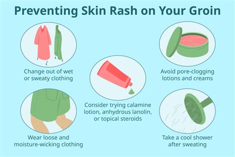Prevention of Heat Rash