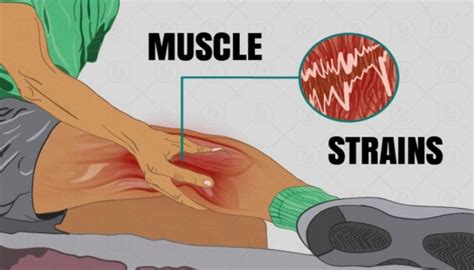 Prevention of Muscle Strains
