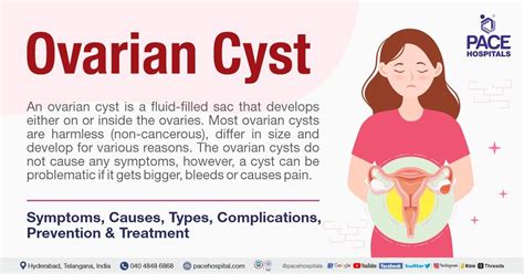 Prevention of Perforated Ovarian Cyst