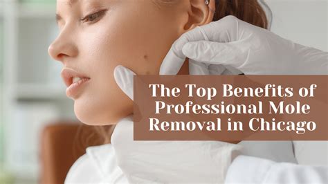 Professional Mole Removal