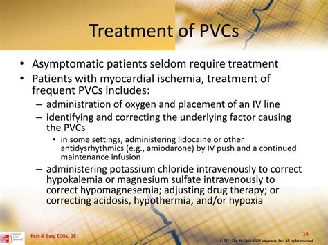 Pvcs Symptoms