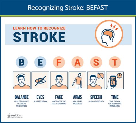 Recognizing Strokes