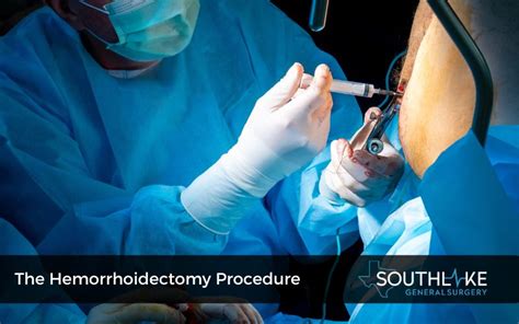 Recovery from Hemorrhoid Surgery